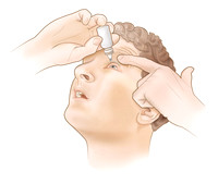 How to use eye drops