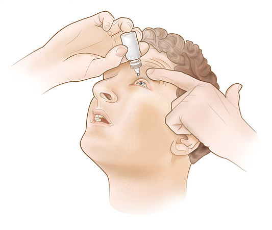 How to use eye drops