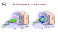 H. pylori