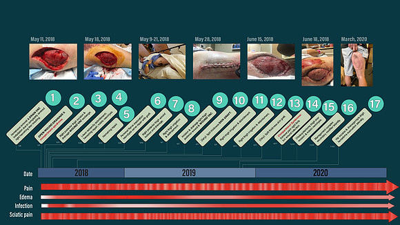 Timeline of 17 surgeries